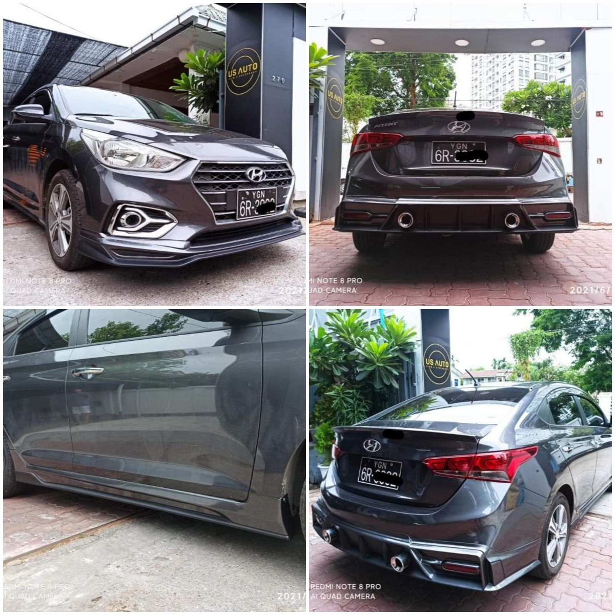 BODY KIT (THAI)